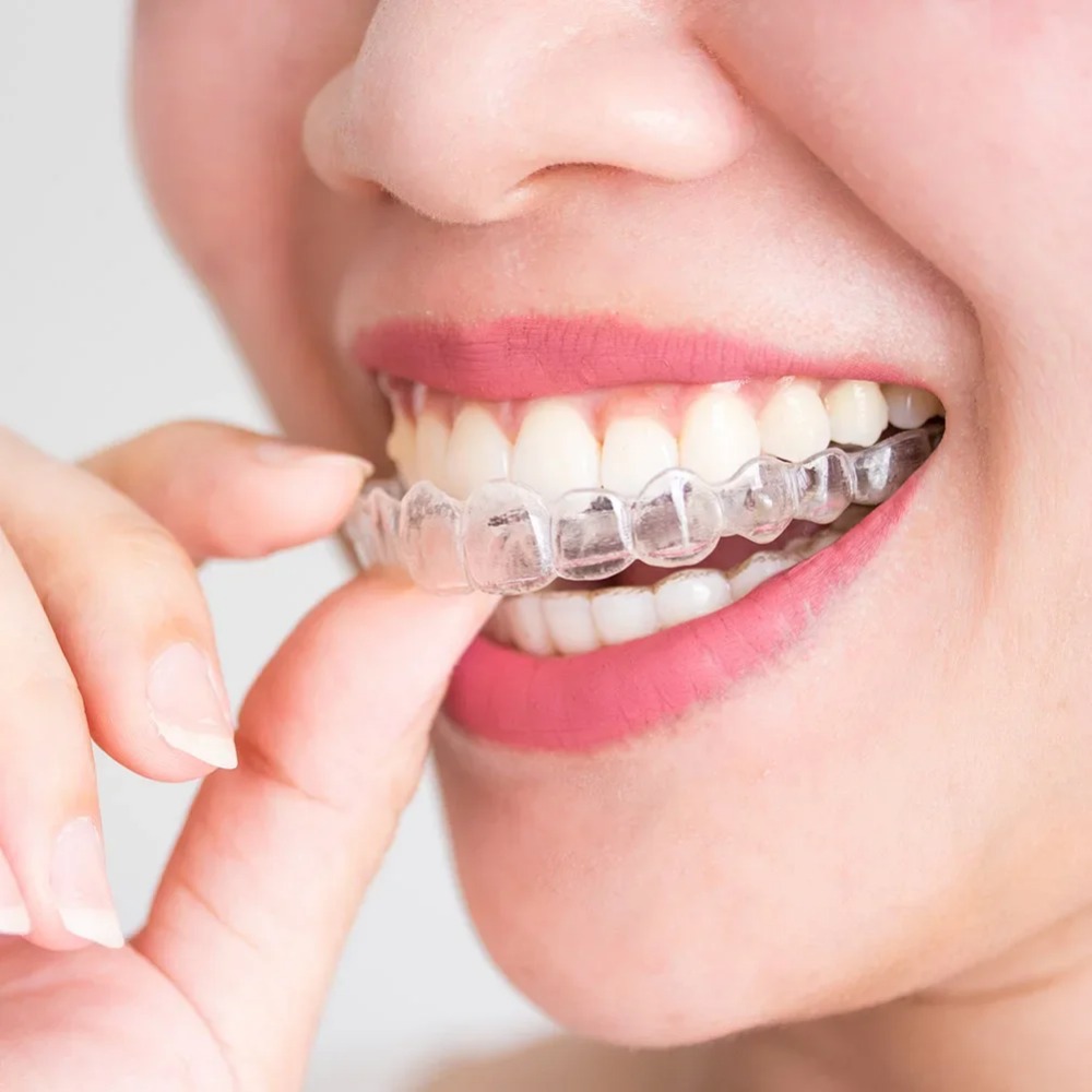 Teeth Whitening Mouth Guard - Protetor Bucal Noturno Anti Ronco e