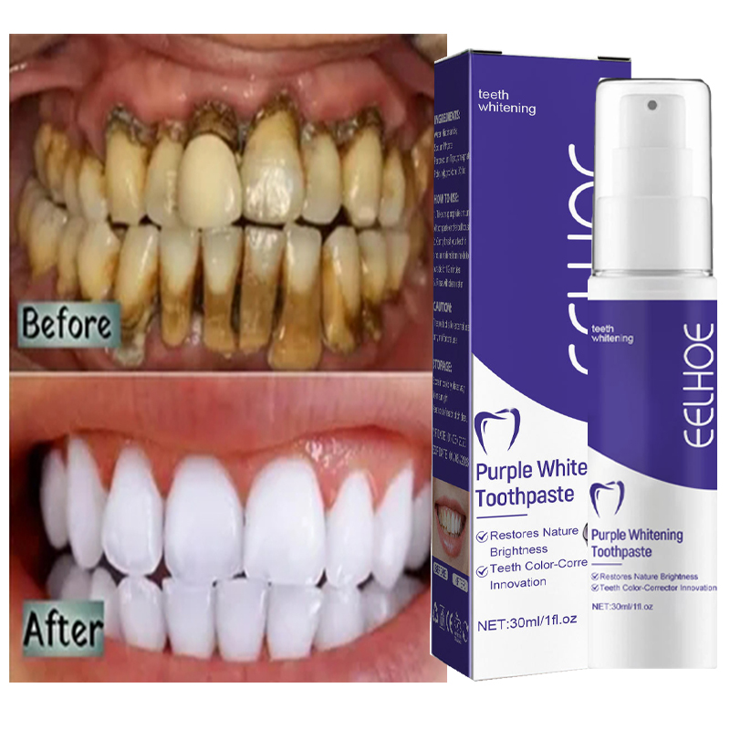 Teeth Whitening In Korea - Creme dental clareador para limpeza dos
