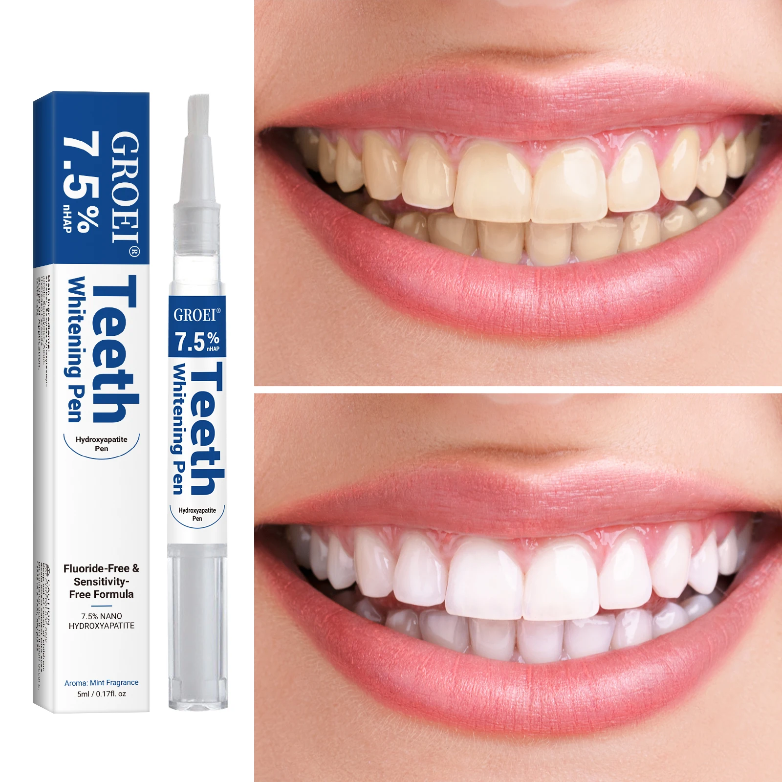 Caneta branqueadora de dente h - Teeth Whitening Vape avaliação e preço