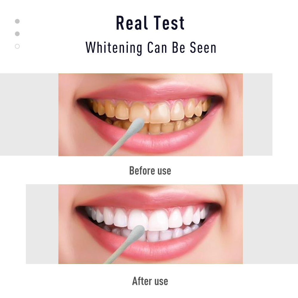 Tslm2 caneta gel clareador, ti - Whitening Pen Bleach avaliação e preço