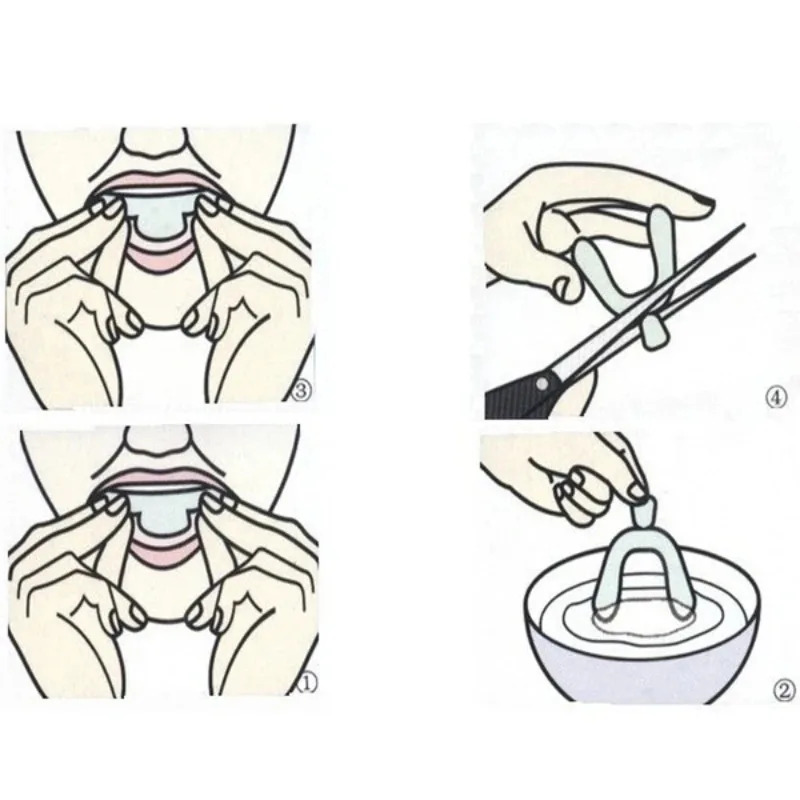Protetor Bucal de Silicone (1/ - Teeth Whitening Mouth Guard avaliação e preço
