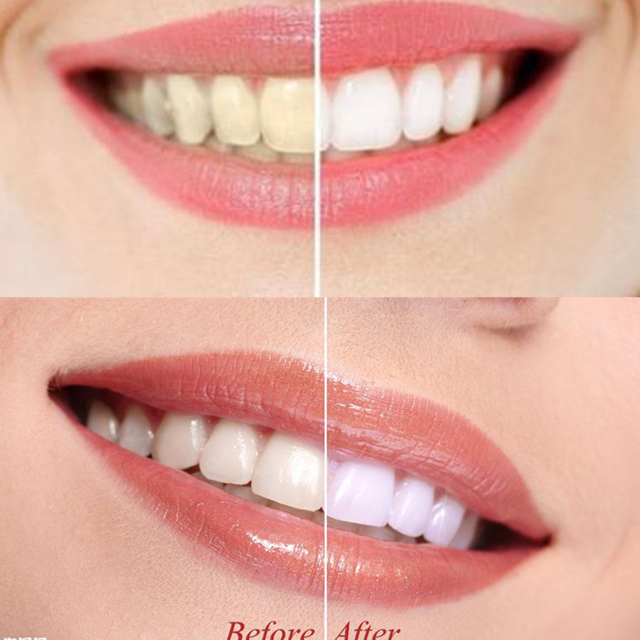 Dentes de carvão vegetal de ba - Teeth Whitening Vape avaliação e preço