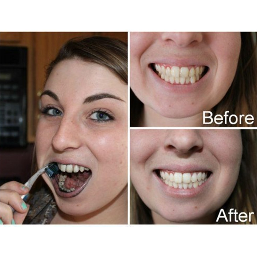 Dentes de carvão vegetal de ba - Teeth Whitening Vape avaliação e preço