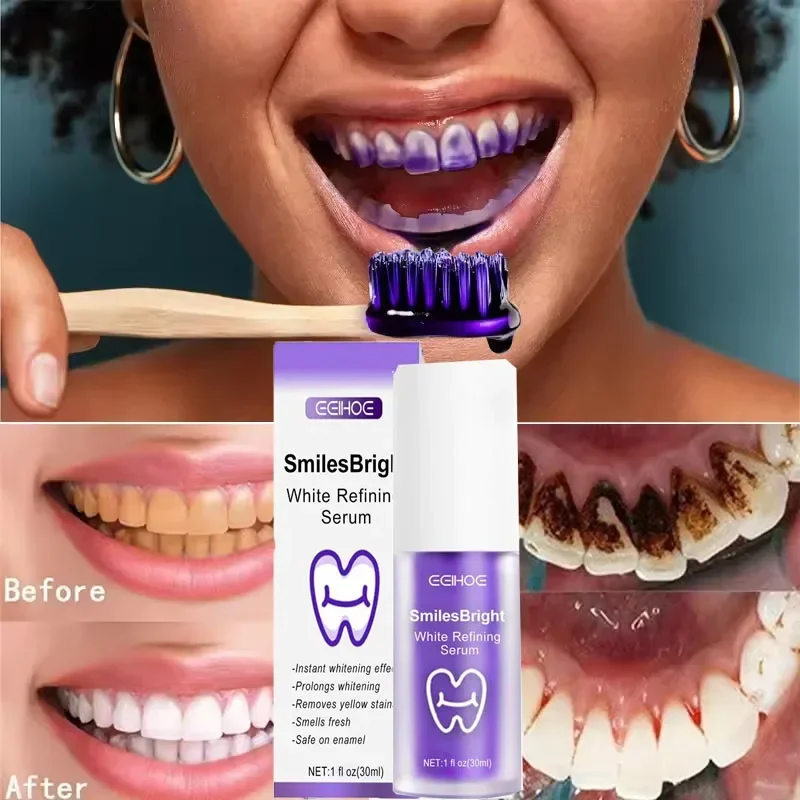 Limpeza dos dentes branqueamen - Teeth Whitening In Korea avaliação e preço