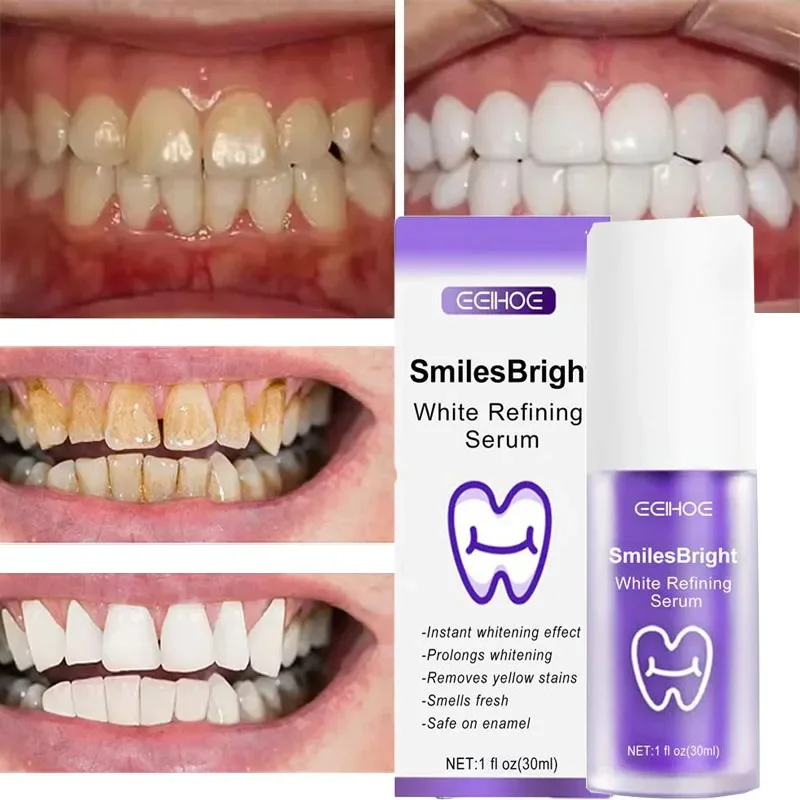 Limpeza dos dentes branqueamen - Teeth Whitening In Korea avaliação e preço