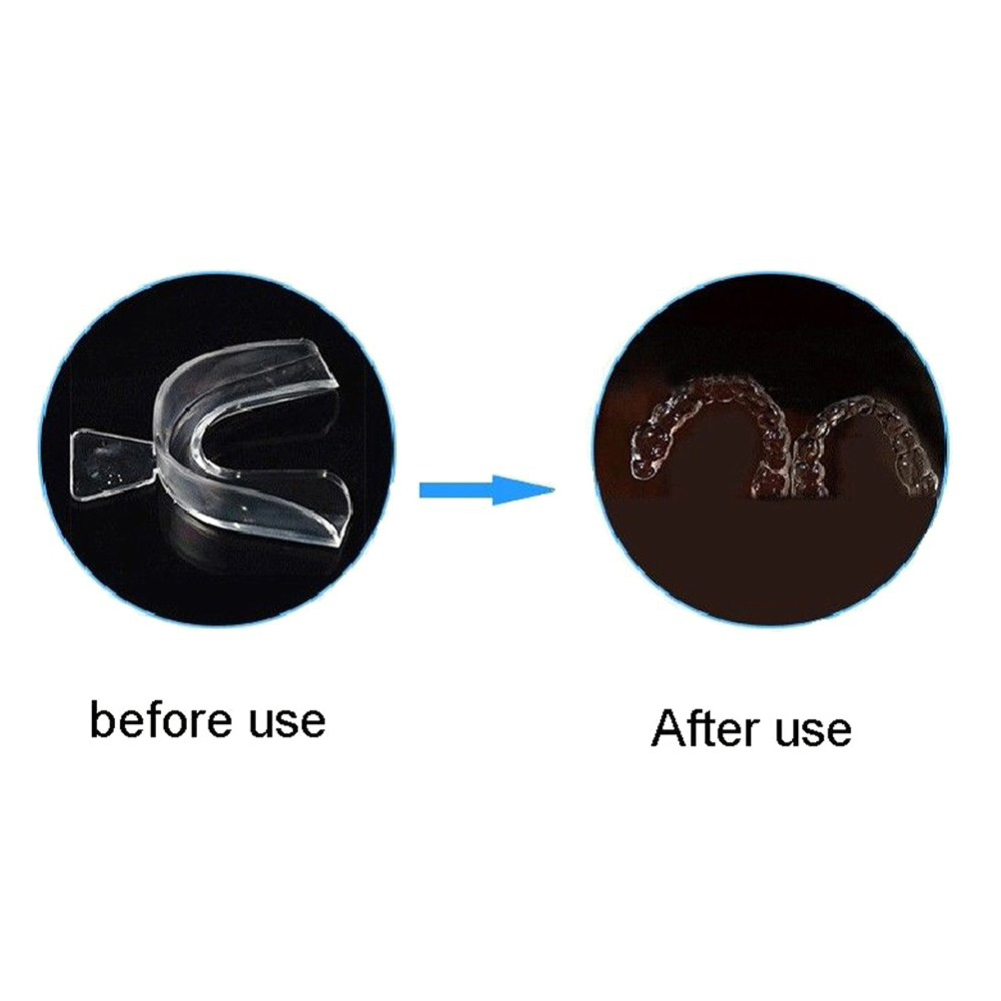 Conjunto de 2/4 Peças de Prote - Teeth Whitening Mouth Guard avaliação e preço
