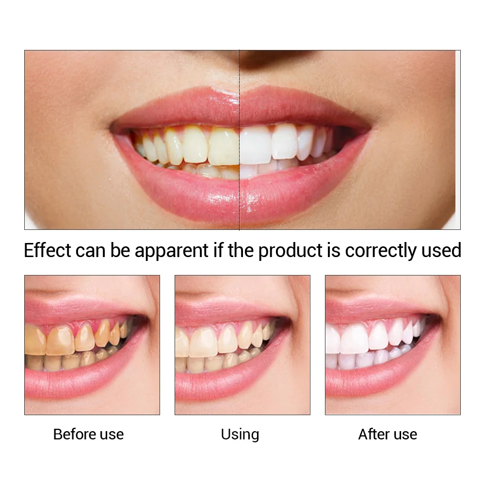 FTEENPLY Essência para claream - Teeth Whitening Vape avaliação e preço