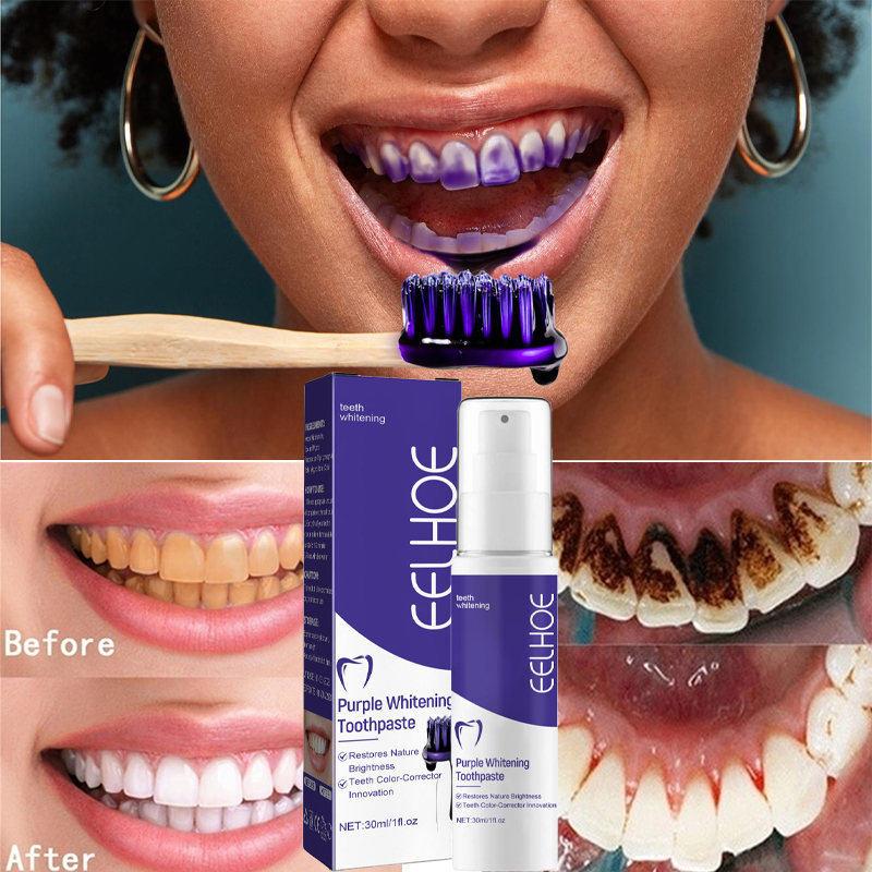 Creme dental clareador para li - Teeth Whitening In Korea avaliação e preço
