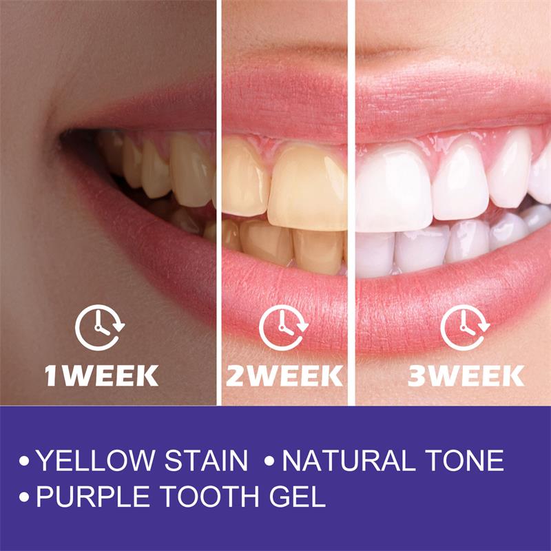 Creme dental clareador para li - Teeth Whitening In Korea avaliação e preço