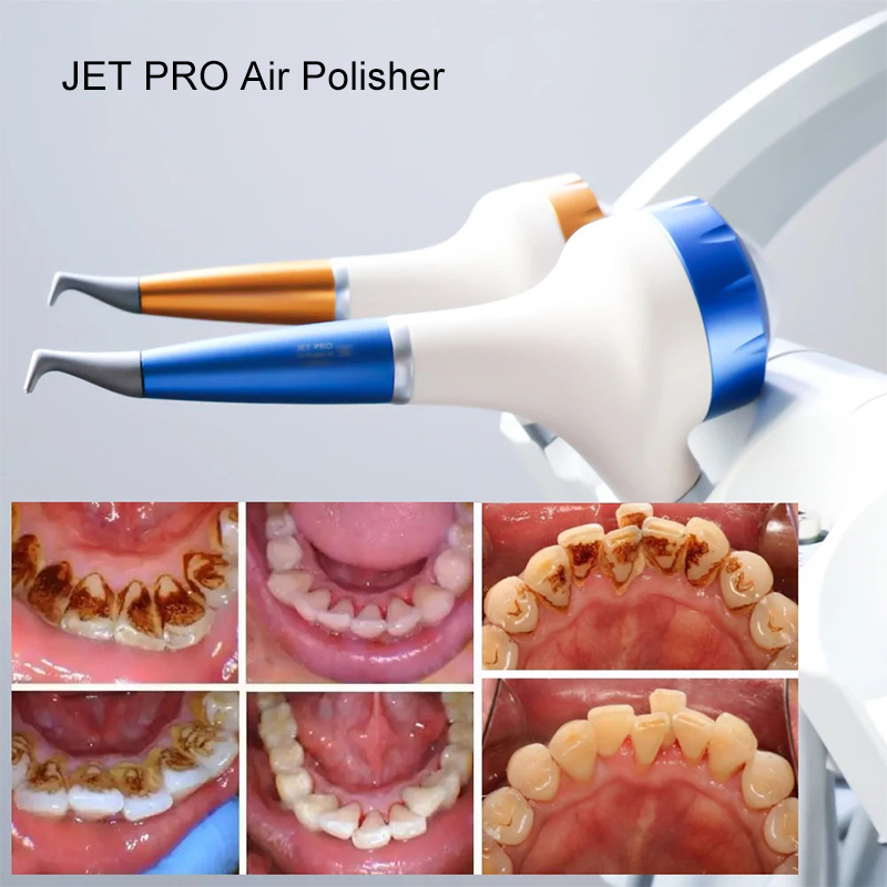 VV Dental Air Polishing Prophy - Teeth Whitening Usa avaliação e preço