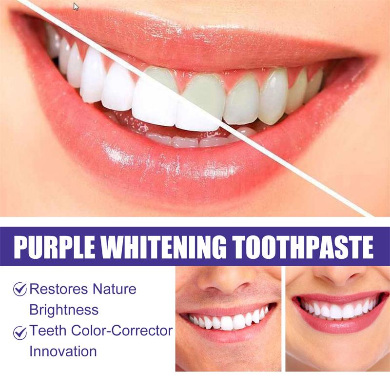 Pasta de Dente Clareadora e Ge - Teeth Whitening In Korea avaliação e preço