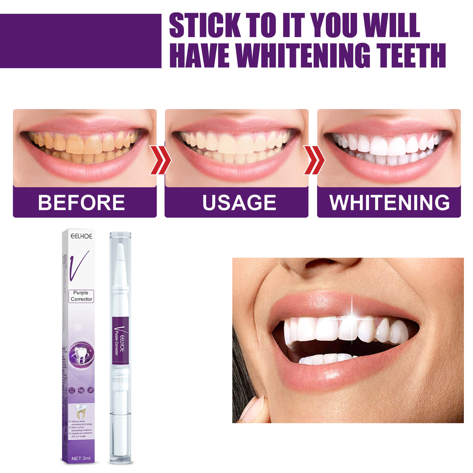 Caneta pasta de dente roxa par - Whitening Pen Bleach avaliação e preço