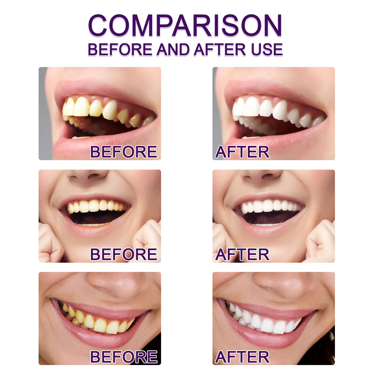 Caneta pasta de dente roxa par - Whitening Pen Bleach avaliação e preço