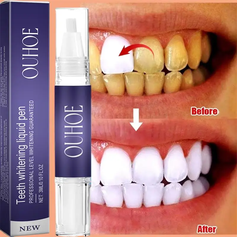 5 Pontas de Ultrassom Odontoló - Teeth Whitening Usa avaliação e preço
