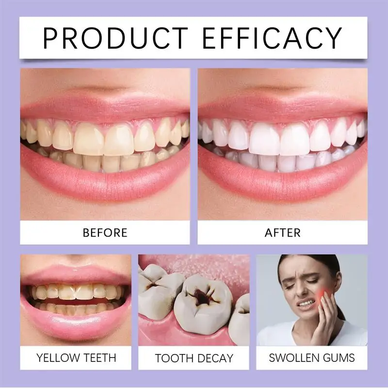 5 Pontas de Ultrassom Odontoló - Teeth Whitening Usa avaliação e preço